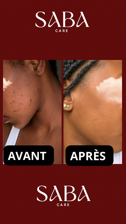 DAILY SKIN DUO